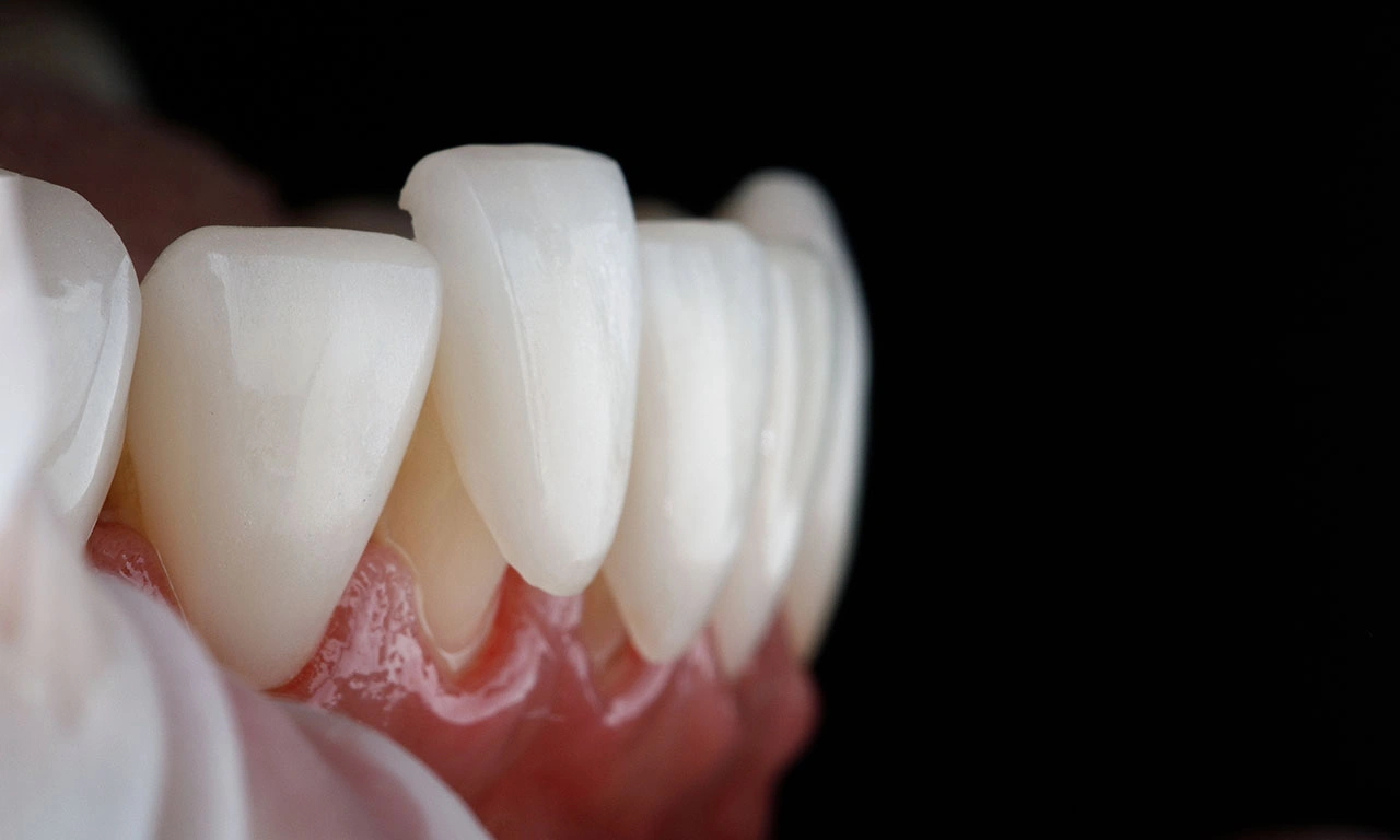 Quality Premium Dental